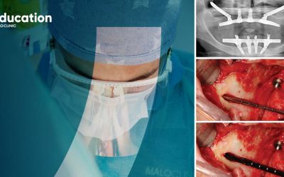 All-on-4® Surgical Protocol – High Skilled & Zygoma Maxilla Rehabilitation | April Edition