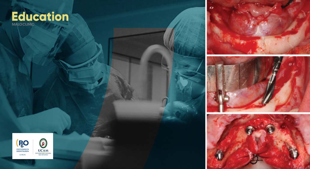 All-on-4_Surgical Protocol Clinical Course_NewBranding