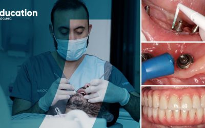 Implant Maintenance – A Practical Approach | October Edition