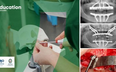 Cadaver Course | All-on-4® Surgical Protocol – From Standard to Zygoma Cases: July Edition
