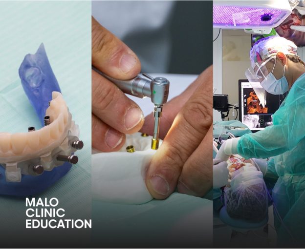 All-on-4® Surgical Protocol: From Analog to Digital • MALO CLINIC Education