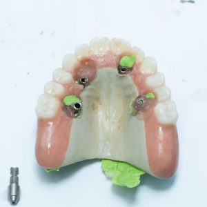 Fotos_CursoZygoma CR_06-03511